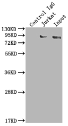 SUZ12 Antibody