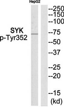 SYK (Phospho-Tyr352) Antibody