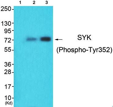 SYK (Phospho-Tyr352) Antibody