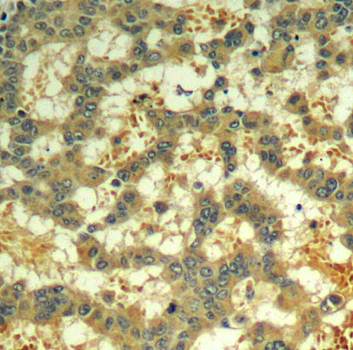 syk (phospho-Tyr323) Antibody