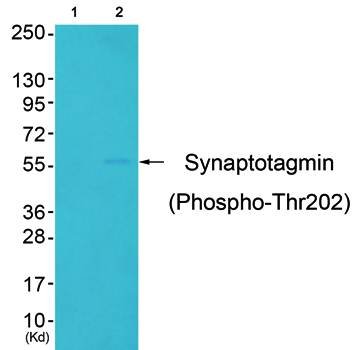 Synaptotagmin (Phospho-Thr202) Antibody