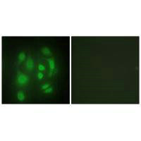 SYNCRIP Antibody