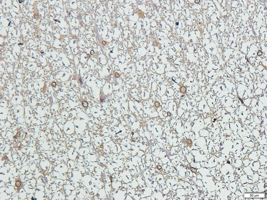 Syndecan 2 Rabbit Polyclonal Antibody