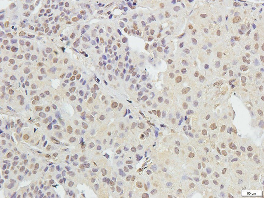 Syndecan 2 Rabbit Polyclonal Antibody