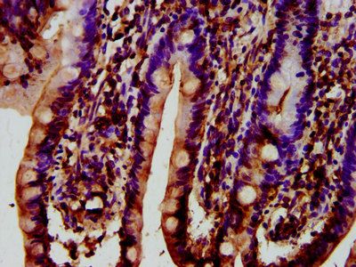 SYNJ1 Antibody