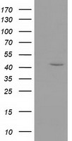 TACC3 Antibody