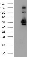 TACC3 Antibody