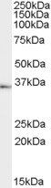 TACR1 Antibody