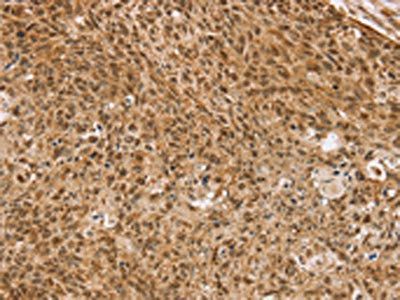 TAF12 Antibody