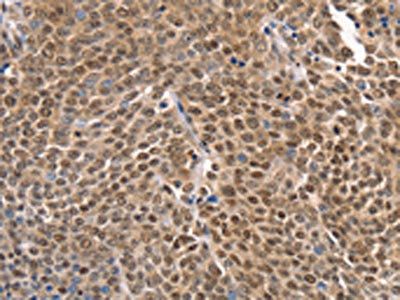 TAF15 Antibody