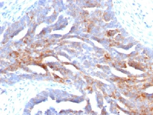 TAG-72 / CA72.4 (Tumor-Associated Glycoprotein) Antibody