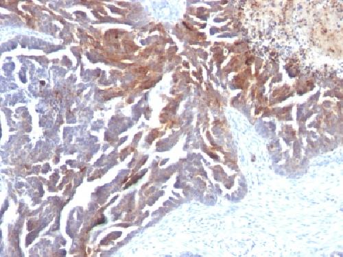 TAG-72 / CA72.4 (Tumor-Associated Glycoprotein) Antibody