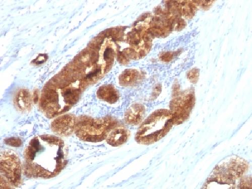TAG-72 / CA72.4 (Tumor-Associated Glycoprotein) Antibody