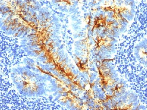 TAG-72 / CA72.4 (Tumor-Associated Glycoprotein) Antibody