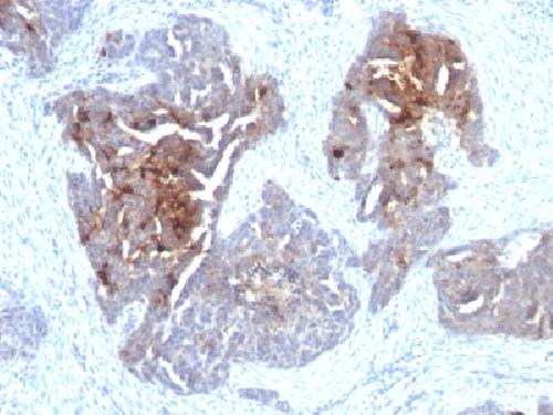 TAG-72 / CA72.4 (Tumor-Associated Glycoprotein) Antibody