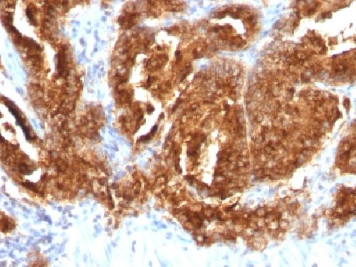 TAG-72 / CA72.4 (Tumor-Associated Glycoprotein) Antibody