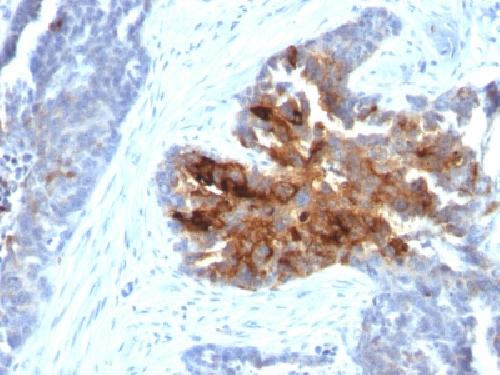 TAG-72 / CA72.4 (Tumor-Associated Glycoprotein) Antibody