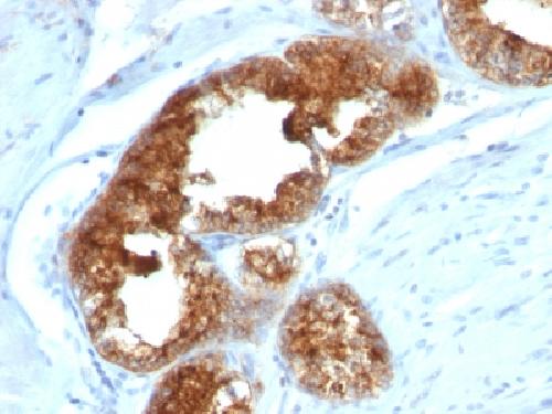 TAG-72 / CA72.4 (Tumor-Associated Glycoprotein) Antibody