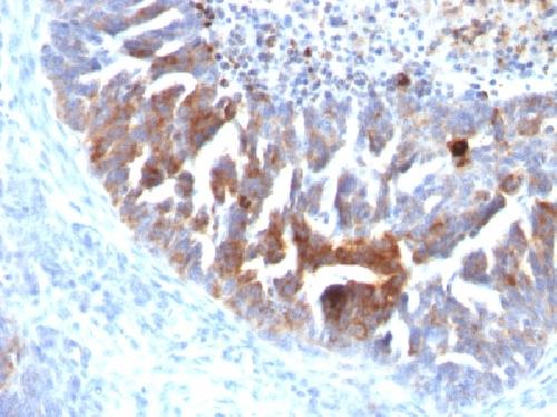TAG-72 / CA72.4 (Tumor-Associated Glycoprotein) Antibody