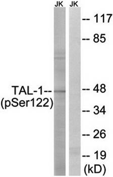 TAL-1 (Phospho-Ser122) Antibody