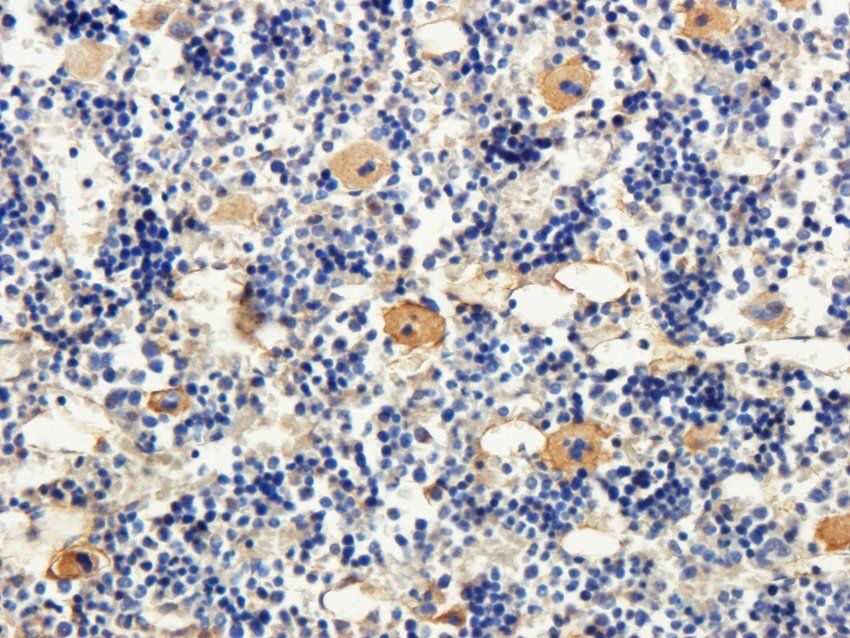 TAL1 antibody