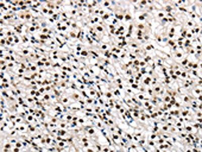 TALDO1 Antibody