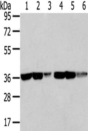 TALDO1 Antibody