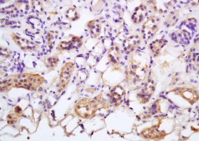 Tankyrase Rabbit Polyclonal Antibody