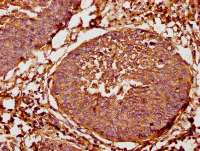 TAP2 Antibody