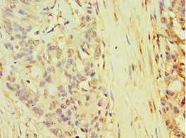 TARBP2 Antibody
