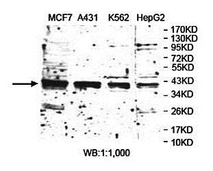 TARBP2 Rabbit Polyclonal Antibody