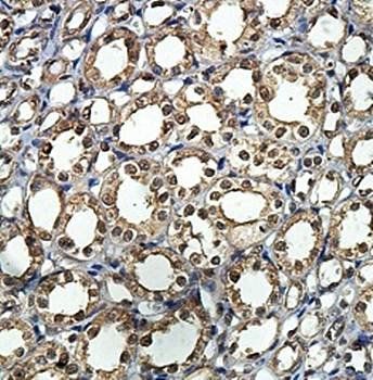 TARBP2 Rabbit Polyclonal Antibody
