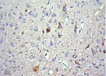 Phospho-Tau (thr 175) Antibody