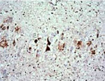 Phospho-Tau (thr 217) Antibody