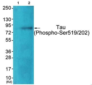 Tau (Phospho-Ser519/202) Antibody