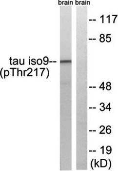 Tau (Phospho-Thr534/217) Antibody