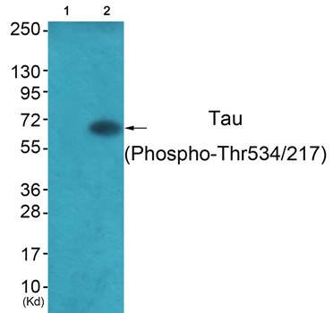 Tau (Phospho-Thr534/217) Antibody