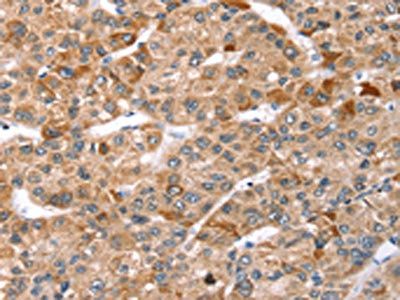 TBC1D1 Antibody