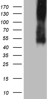 TBL1XR1 Antibody