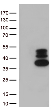 TBL1XR1 Antibody