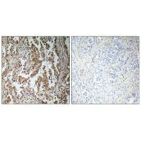 TBPL2 Antibody