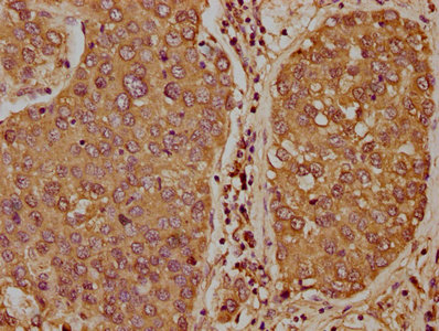 TCL1B Antibody