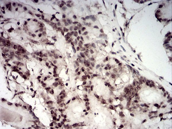 TERT Antibody