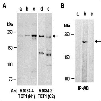 TET1 (N1) Antibody, Rabbit Polyclonal