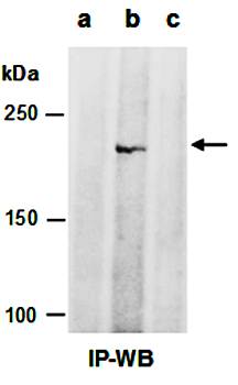 TET1 (vPairTM) Antibodies