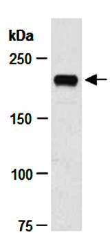 TET2 (NC) Antibody, Rabbit Polyclonal
