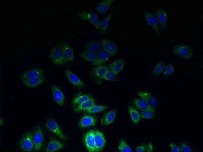 TSPAN7 Antibody
