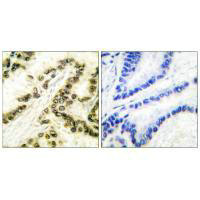 TFAP2A Antibody