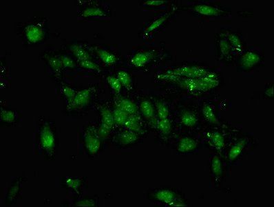 TFE3 Antibody