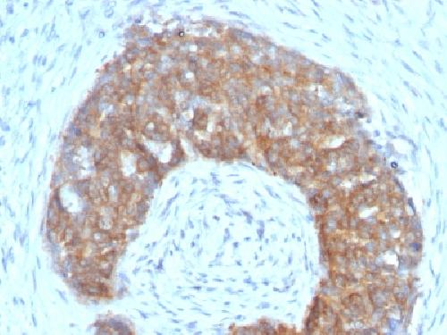 TFF1 Antibody